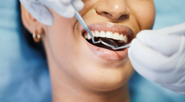 Best Same-Day Emergency Dental Services in Staunton, VA